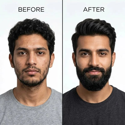 Dr. Alies Professional Beard Growth Oil | Natural Beard Care Oil for Patchy & Thin Beards | Moisturizing, Itch & Dandruff Care | 30ml